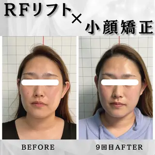 小顔矯正専門店 【RED】池田のエステ・リラクイメージ
