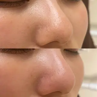 Eyelash salon MORE(モア)所属・安納 麻穂のエステ・リラクイメージ