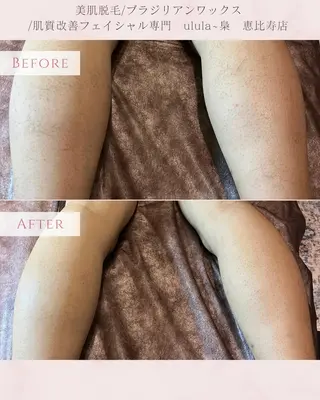 美肌脱毛/肌質改善 《ulula～梟》のエステ・リラクイメージ