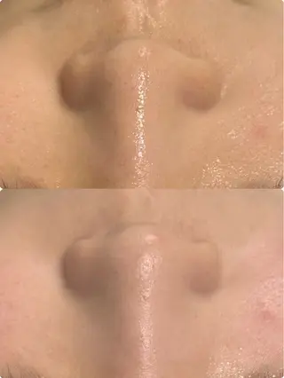 メンズ レセラ銀座所属・レセラ 銀座のエステ・リラクイメージ