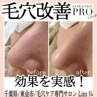 Lim Naomiのマツエク・マツパデザイン