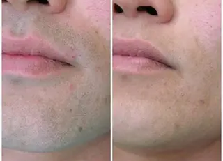 メンズ 茶谷 梨紗のエステ・リラクイメージ