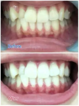 M渋谷店所属・Ｍ渋谷 ホワイトニングのエステ・リラクイメージ