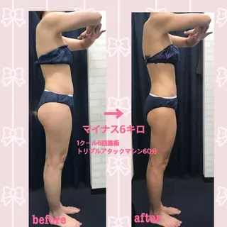 アイトータル ビューティーのエステ・リラクイメージ