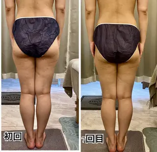 infinity所属・Infinity インフィニティのエステ・リラクイメージ