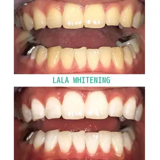 ララホワイトニング  大分駅前店所属・ララホワイトニング 大分駅前店のその他イメージ