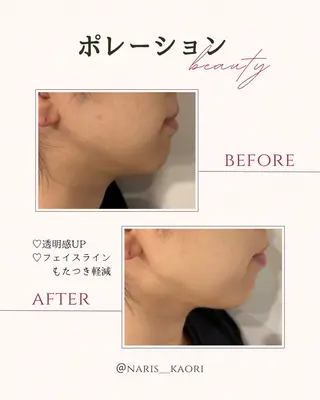 フェイシャルエステ♡ KAORIのエステ・リラクイメージ