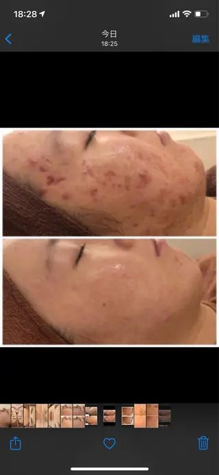 触れたくなる モテ肌へ...❤︎のエステ・リラクイメージ