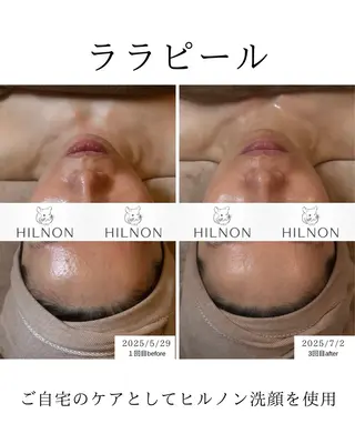 RUPO THE MAINTENANCE新潟店【ローマピンク公式認定店/ララピール正規店/骨格小顔】所属・オーナー Nanjoのエステ・リラクイメージ