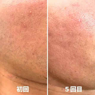 メンズ salon Removeのエステ・リラクイメージ