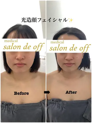 🩵Tatsumi Kana🩵のエステ・リラクイメージ