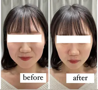 ENCHANT 脱毛.小顔.毛穴のエステ・リラクイメージ