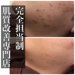 セミロング カラー パーマ ヘアアレンジ メンズ キッズ ネイル マツエク・マツパ ニキビ・肌質改善専門 ♡人生が変わるサロンのエステ・リラクイメージ