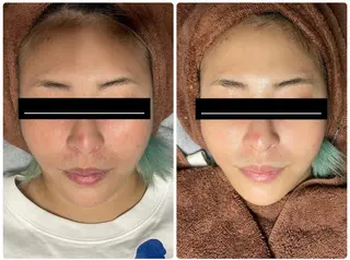 脱毛🌈Beauty Salon新宿店のエステ・リラクイメージ