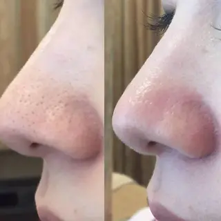 ハーブ🌿小顔❤ 海老名💎大西玲子のエステ・リラクイメージ