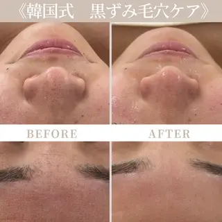 Liam《美肌管理/ 3D小顔/脂肪ケア》のエステ・リラクイメージ