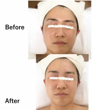 RENsalon大阪 体質改善リトリートのエステ・リラクイメージ