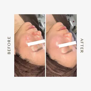 1st｜フェイシャル エステ専門店のエステ・リラクイメージ