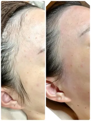 CHICIEL所属・枚方市香里園脱毛 サロンCHICIELのエステ・リラクイメージ