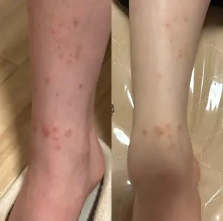 a room salonのエステ・リラクイメージ