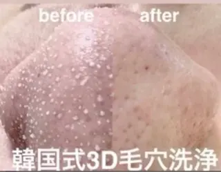 ADDICT中目黒店所属・毛穴洗浄/毛穴ケア 🌿中目黒🌿のエステ・リラクイメージ