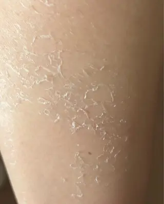 clé skin 🌿ハーブピーリングのエステ・リラクイメージ