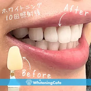 メンズ ホワイトニング カフェ志木店のエステ・リラクイメージ