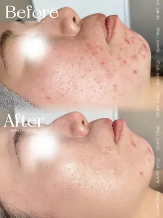 Sui所属・Sui Eye & Beautyのマツエク・マツパデザイン