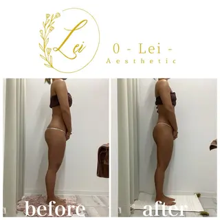 0-Lei-aesthetic所属・レイエステティック スタッフのエステ・リラクイメージ