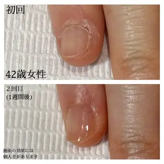 ネイル 自爪育成専門サロン エムロードゥ池下のネイルデザイン