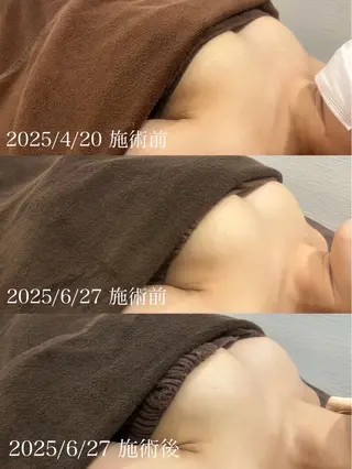 【Beauel】 ここあのエステ・リラクイメージ