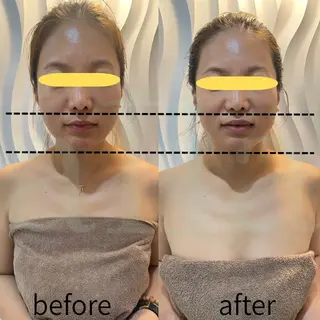 aliaハイフ&水光ジェットサロン所属・aliaハーブ水光店 エステティシャン募集のエステ・リラクイメージ