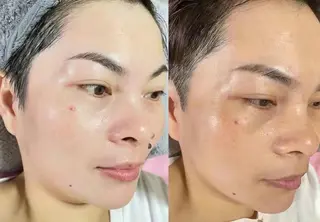 aliaハイフ&水光ジェットサロン所属・aliaハーブ水光店 エステティシャン募集のエステ・リラクイメージ