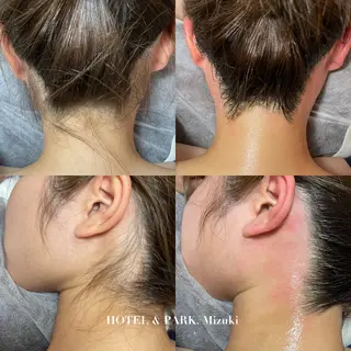 HOTEL&PARK . ワックス脱毛のエステ・リラクイメージ