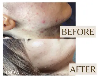 Salon💫 Lino'a柏店のエステ・リラクイメージ