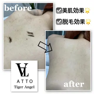 ATTO SHIORIのエステ・リラクイメージ