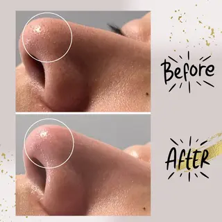 ピーリング専門店 Belluteのエステ・リラクイメージ