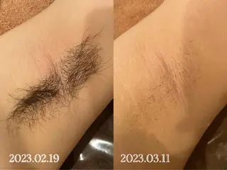 美肌脱毛専門店 ディオーネ四日市店のエステ・リラクイメージ