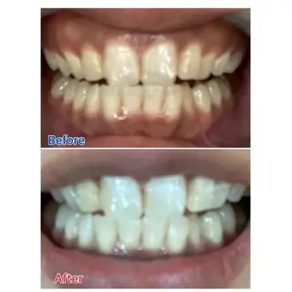 M渋谷店所属・M渋谷 ホワイトニングのエステ・リラクイメージ