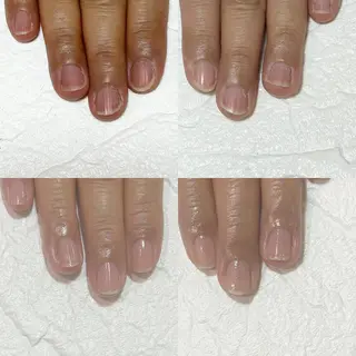 ネイル 自爪育成・巻き爪 補正講師　津蔵のネイルデザイン