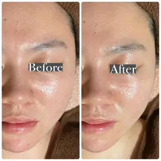 beauty salon  SUKOBI所属・ﾋﾞｭｰﾃｨｻﾛﾝ SUKOBIのエステ・リラクイメージ