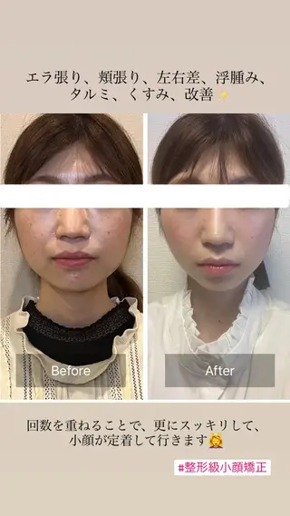 柳瀬 絵美のマツエク・マツパデザイン