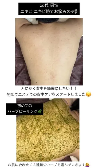 ベラージュ【美背中・ 美尻・フェイシャル】のエステ・リラクイメージ