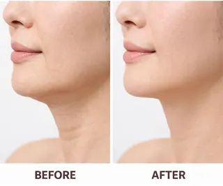 サトウ アキヨのエステ・リラクイメージ