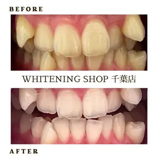 メンズ ホワイトニング ショップ千葉店のその他イメージ