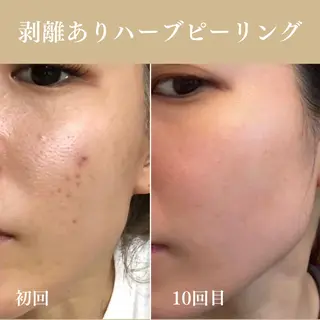 Oncebell. Bodymake&beautysalon所属・Oncebell. ワンベルのエステ・リラクイメージ