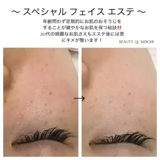 マツエク・マツパ ビューティー ミロワールのエステ・リラクイメージ