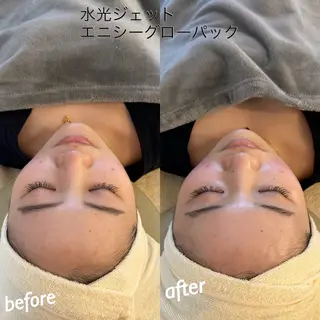 うなじ脱毛/美肌脱毛 LABELのエステ・リラクイメージ