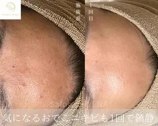 サロンドレナ名駅店所属・ハーブピーリング専門 サロンドレナ平岡のエステ・リラクイメージ