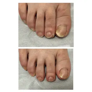 なが さきのネイルデザイン